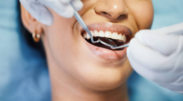 Best Emergency Dental Care for Abscessed Tooth in Saylorsburg, PA