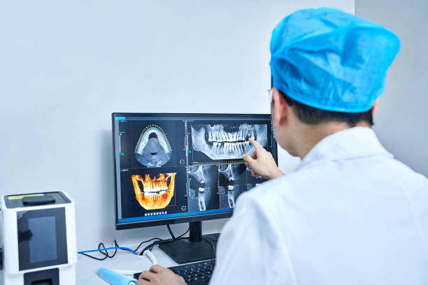 Best Emergency Root Canal Treatment in Saylorsburg, PA